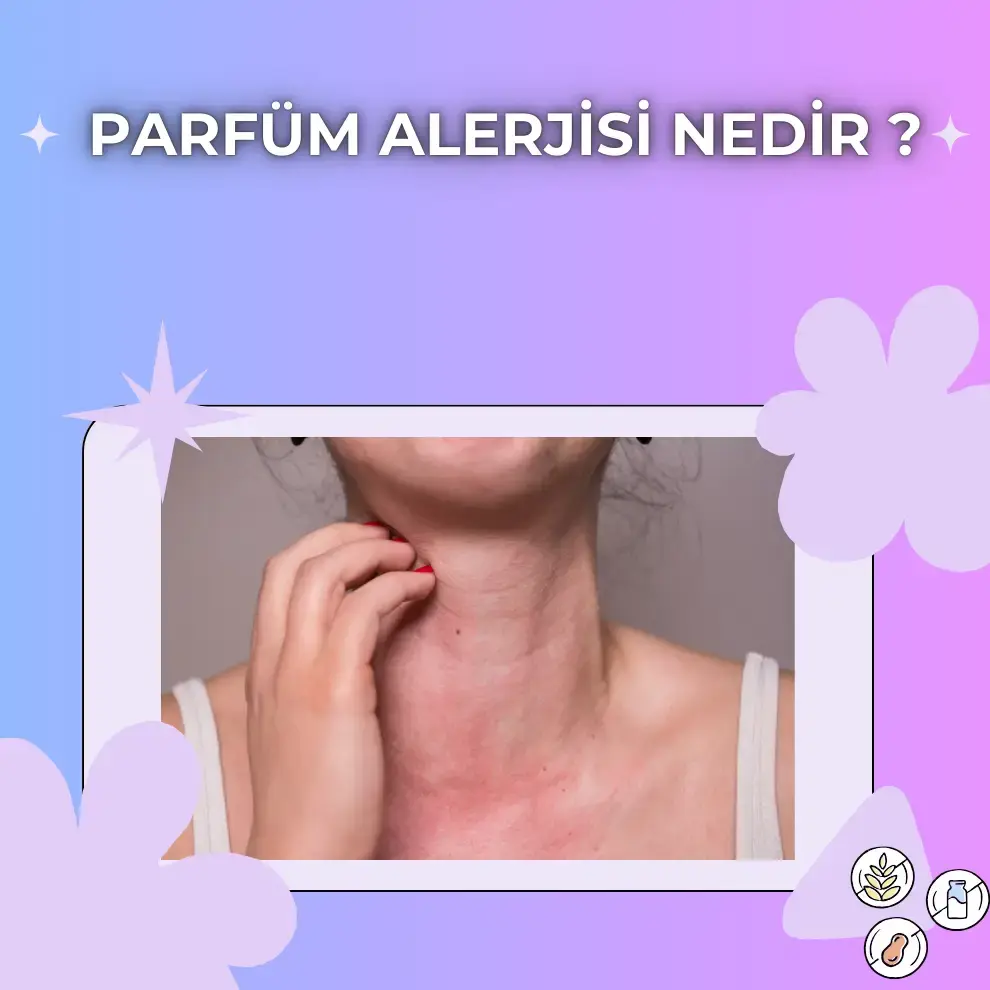 Parfüm Alerjisi Nedir